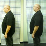 Before-After-ABC-Chiropractic-Nyack-1