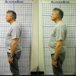 Before-After-ABC-Chiropractic-Nyack-3