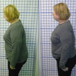 Before-After-ABC-Chiropractic-Nyack-7