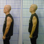 Before-After-ABC-Chiropractic-Nyack-8
