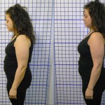 Before-After-ABC-Chiropractic-Nyack-9